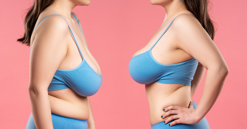 Breast Implant Types